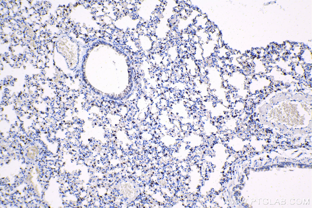 Immunohistochemical analysis of paraffin-embedded mouse lung tissue slide using KHC1414 (CD68 IHC Kit).