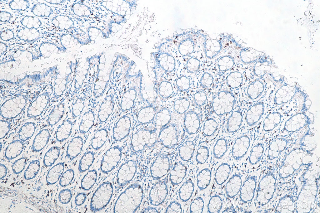 Immunohistochemical analysis of paraffin-embedded human colon tissue slide using KHC0014 (CD8 IHC Kit).