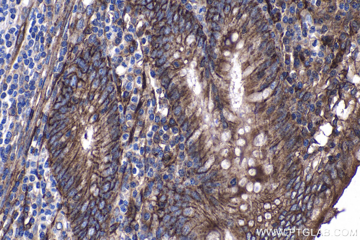 Immunohistochemical analysis of paraffin-embedded human appendicitis tissue slide using KHC1120 (CD9 IHC Kit).