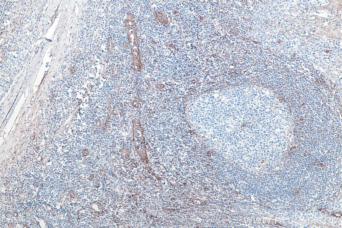 Immunohistochemical analysis of paraffin-embedded human tonsillitis tissue slide using KHC0081 (CD90 IHC Kit).