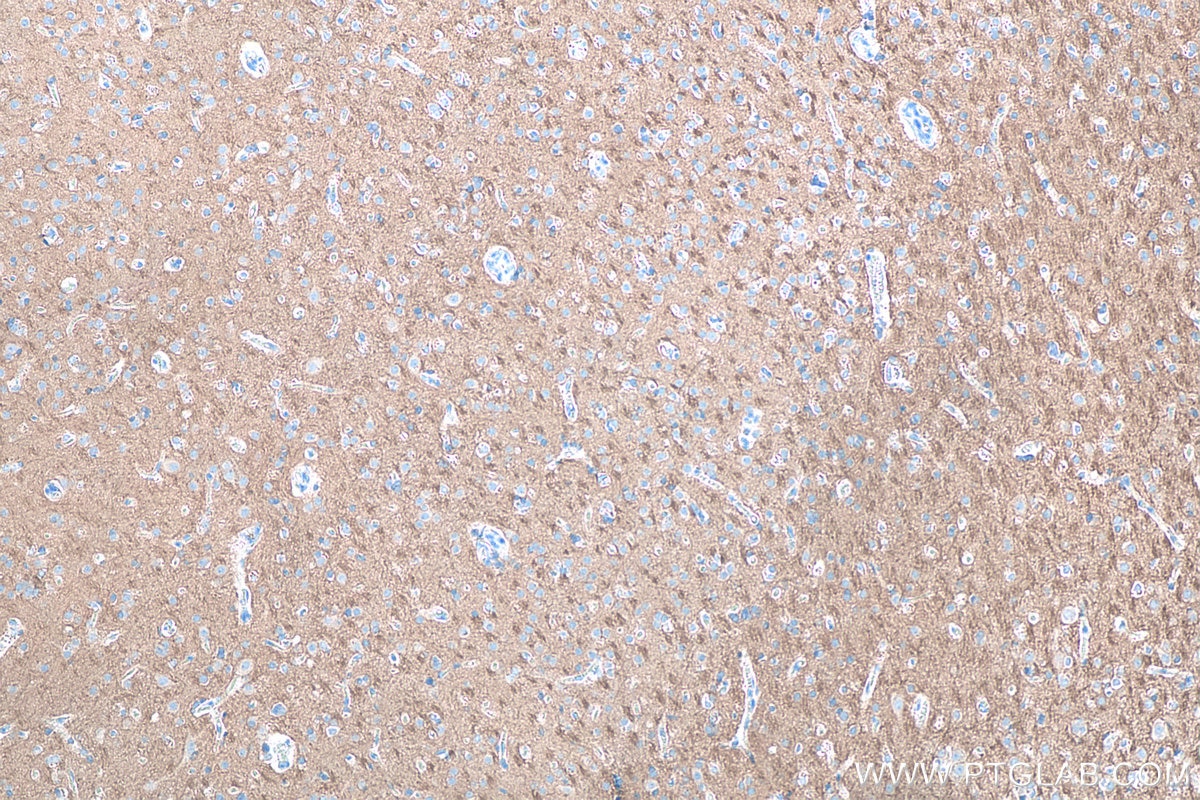 Immunohistochemical analysis of paraffin-embedded human Occipital Cortex tissue slide using KHC0081 (CD90 IHC Kit).