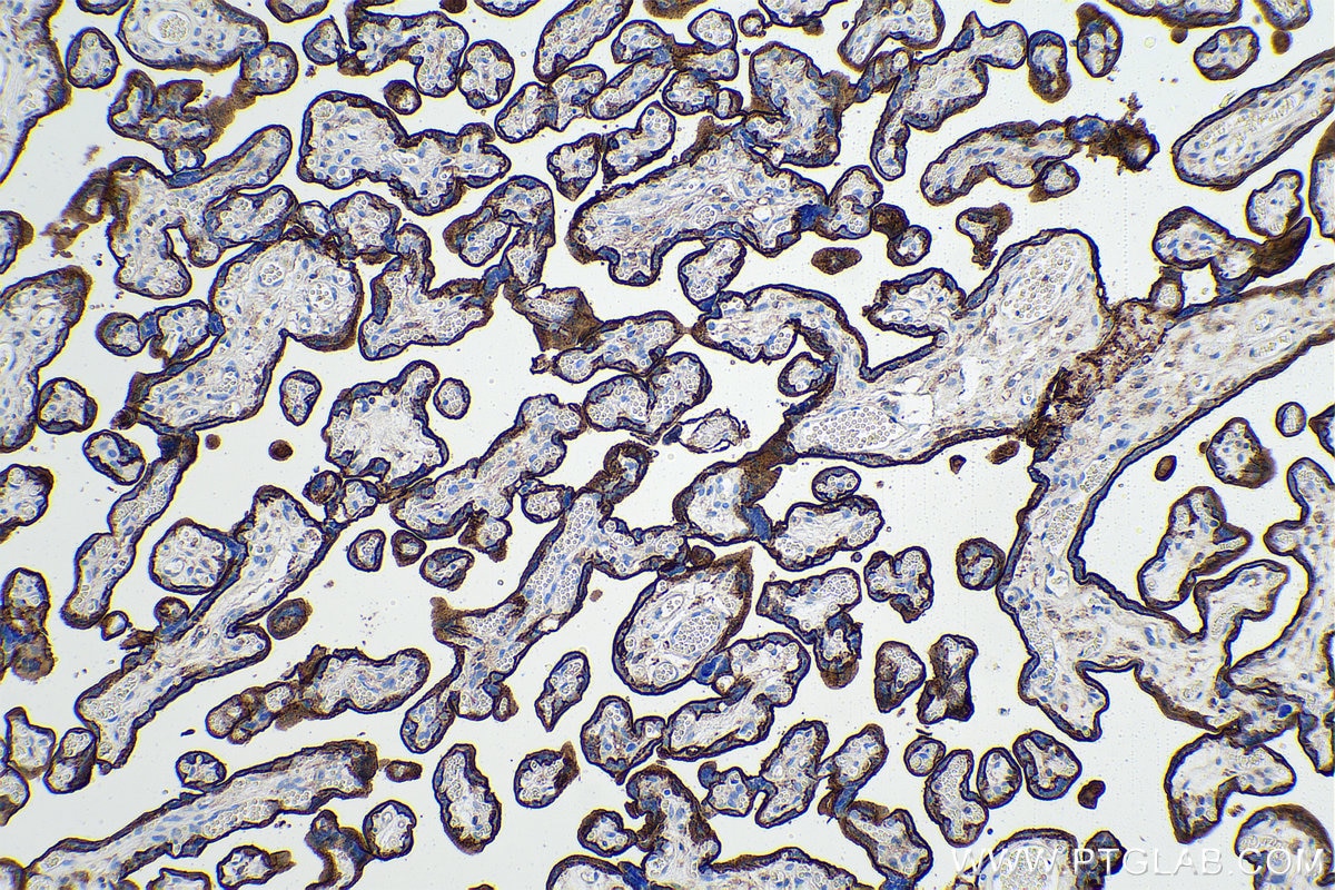Immunohistochemical analysis of paraffin-embedded human placenta tissue slide using KHC0953 (CD98/SLC3A2 IHC Kit).