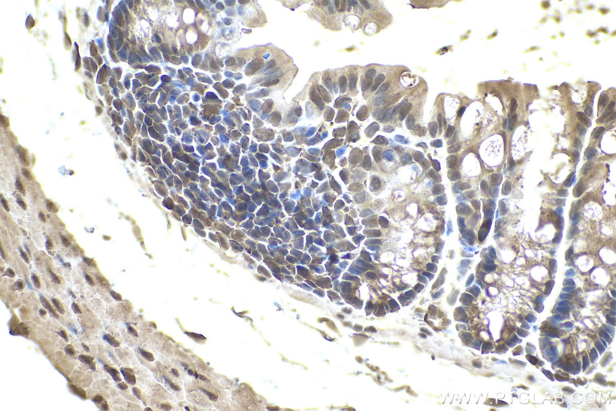 Immunohistochemical analysis of paraffin-embedded mouse colon tissue slide using KHC0805 (CDC25B IHC Kit).