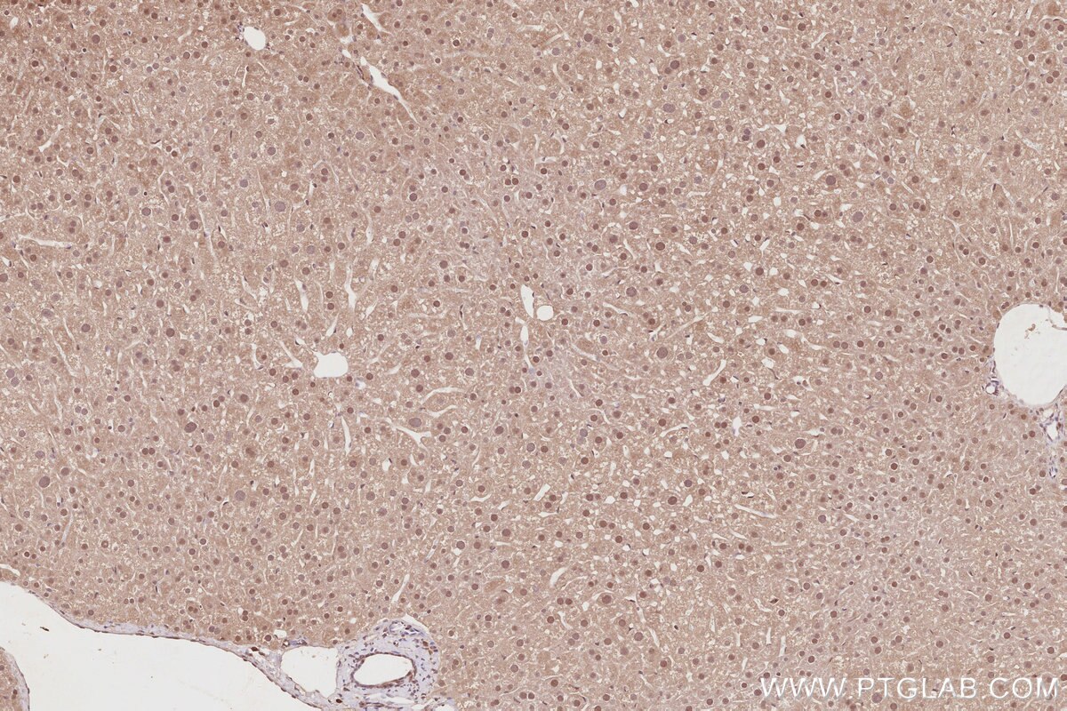Immunohistochemical analysis of paraffin-embedded mouse liver tissue slide using KHC2879 (CDC2L6 IHC Kit).