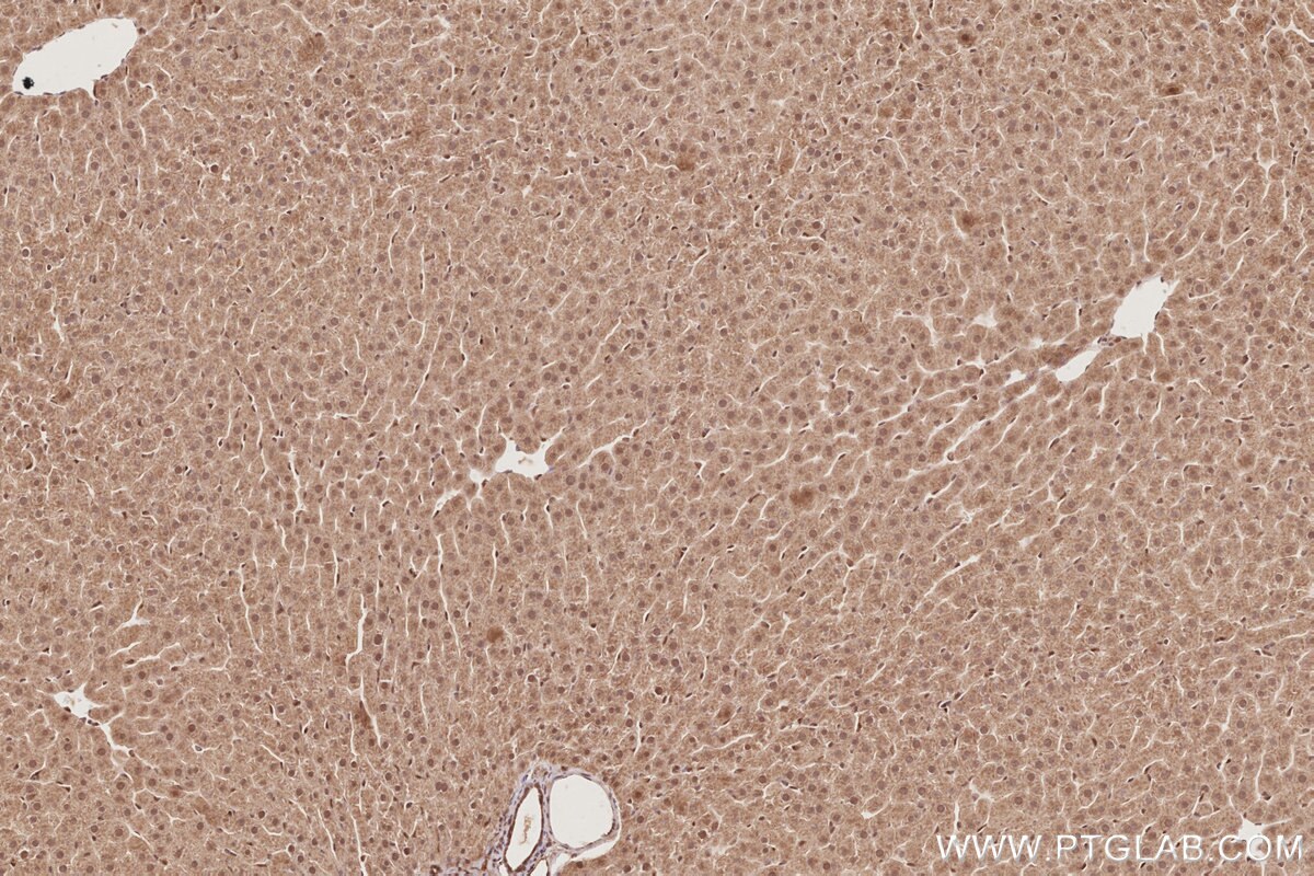 Immunohistochemical analysis of paraffin-embedded rat liver tissue slide using KHC2879 (CDC2L6 IHC Kit).