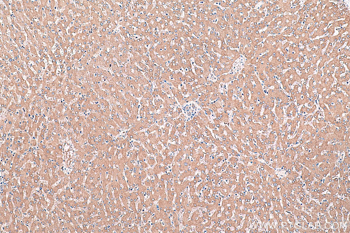 Immunohistochemical analysis of paraffin-embedded human liver tissue slide using KHC0408 (CDC37L1 IHC Kit).