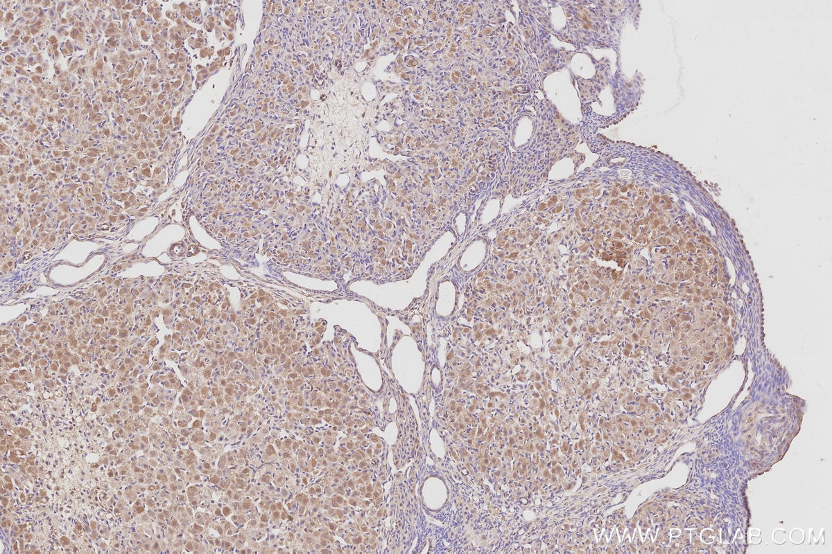 Immunohistochemical analysis of paraffin-embedded rat ovary tissue slide using KHC3080 (CDC42BPB IHC Kit). Immunohistochemical analysis of paraffin-embedded rat ovary tissue slide using KHC3080 (CDC42BPB IHC Kit).