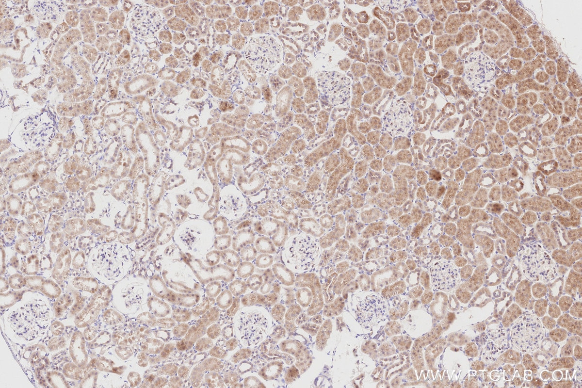 Immunohistochemical analysis of paraffin-embedded rat kidney tissue slide using KHC2911 (CDC42EP4 IHC Kit).