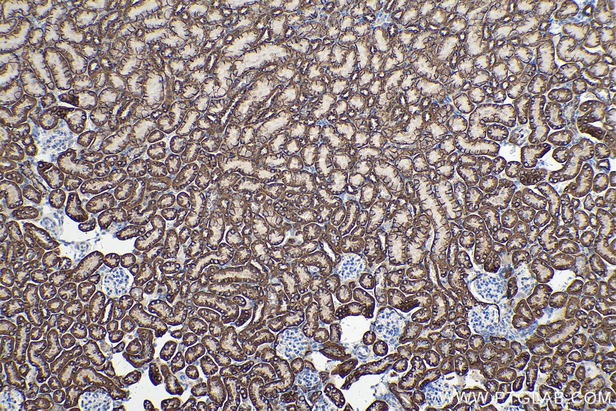 Immunohistochemical analysis of paraffin-embedded mouse kidney tissue slide using KHC0214 (Cadherin-16 IHC Kit).