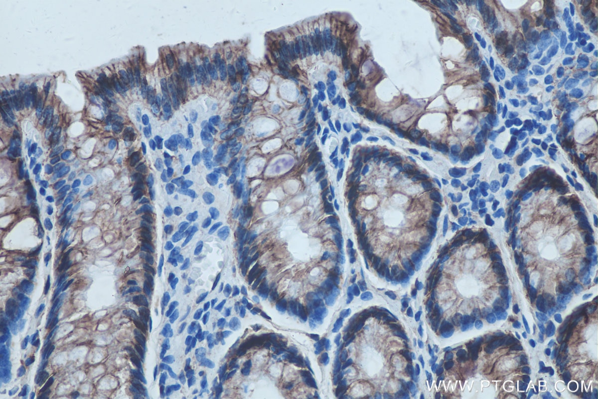 Immunohistochemical analysis of paraffin-embedded rat colon tissue slide using KHC0255 (CDH17 IHC Kit).