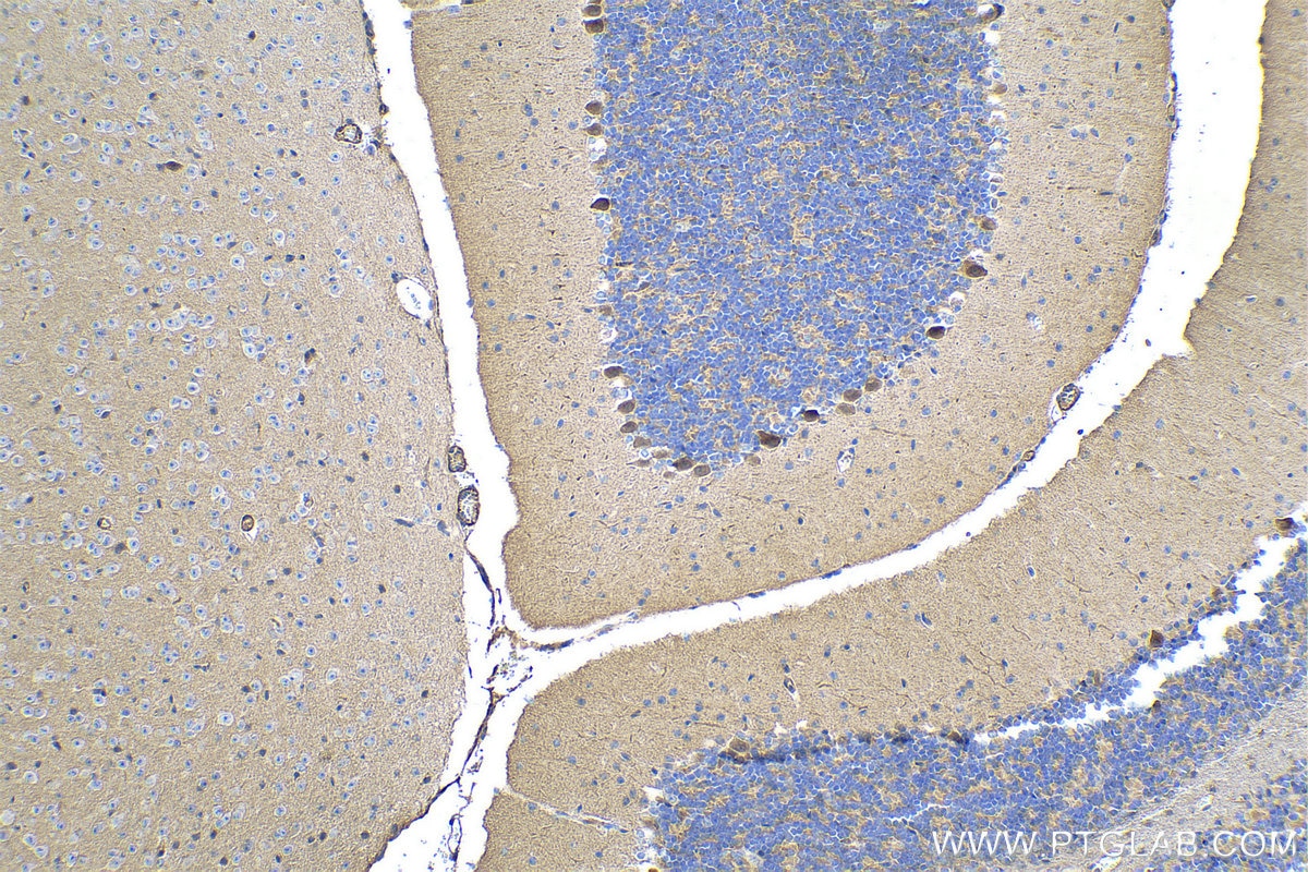 Immunohistochemical analysis of paraffin-embedded mouse cerebellum tissue slide using KHC0298 (CDH18 IHC Kit).
