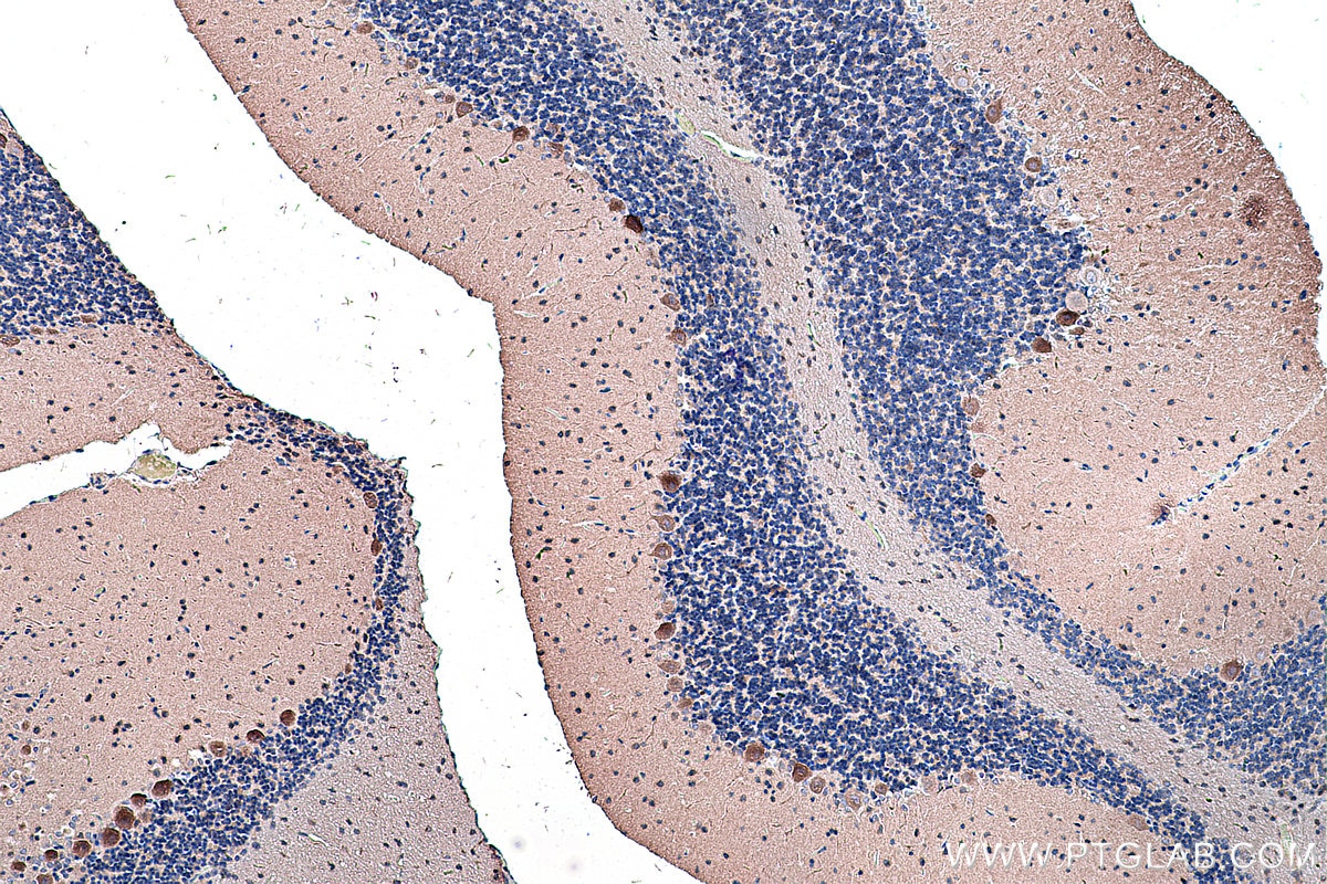 Immunohistochemical analysis of paraffin-embedded rat cerebellum tissue slide using KHC0298 (CDH18 IHC Kit).