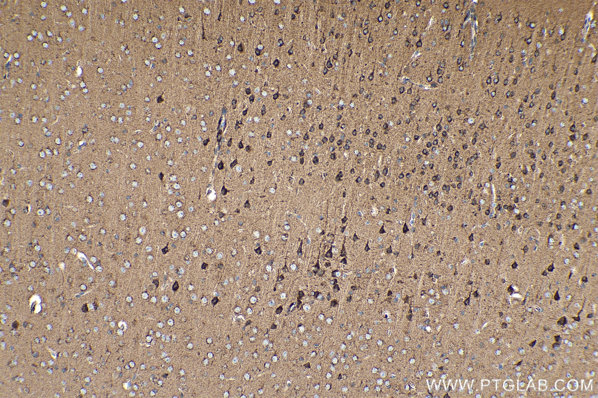 Immunohistochemical analysis of paraffin-embedded mouse brain tissue slide using KHC0254 (CDH7 IHC Kit).