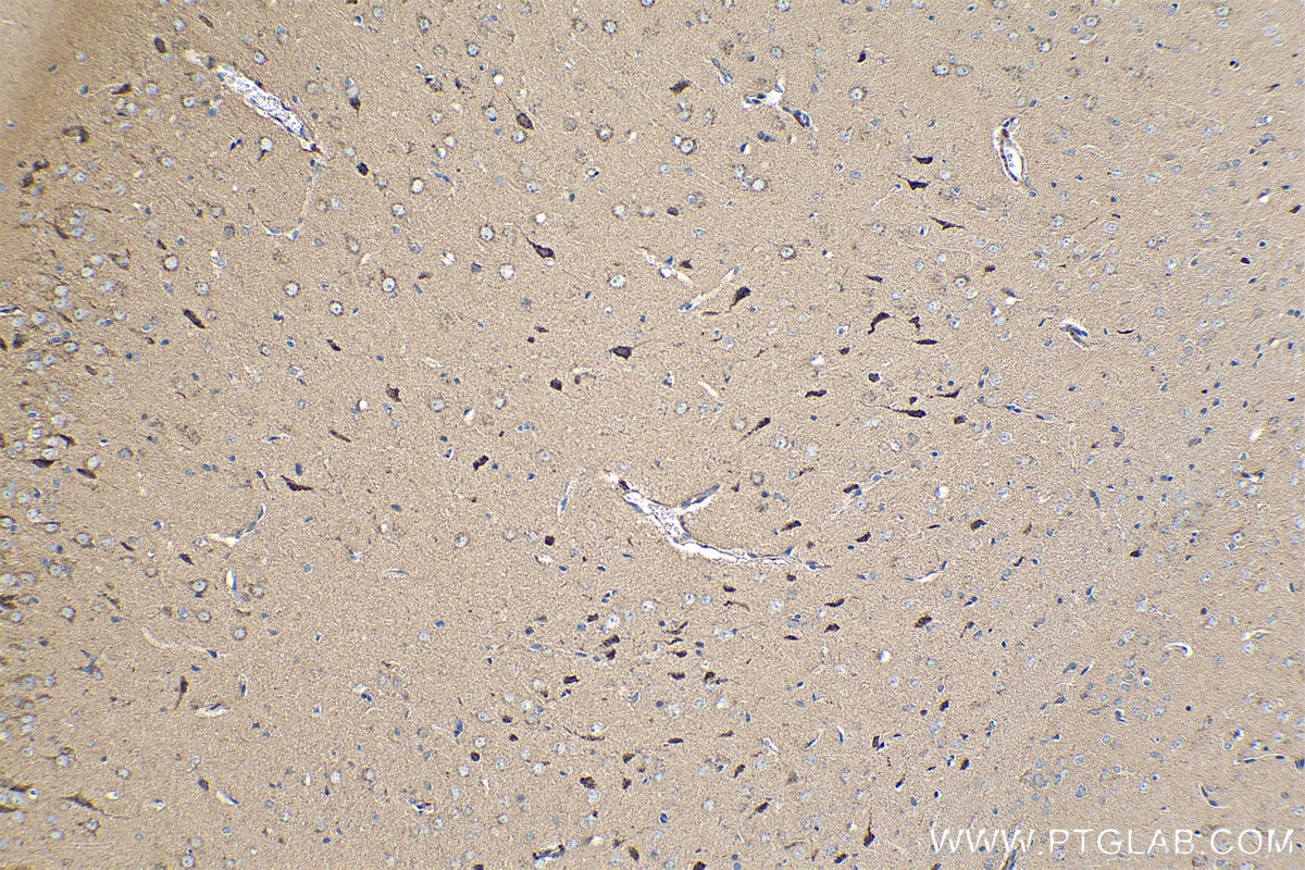 Immunohistochemical analysis of paraffin-embedded rat brain tissue slide using KHC0254 (CDH7 IHC Kit).