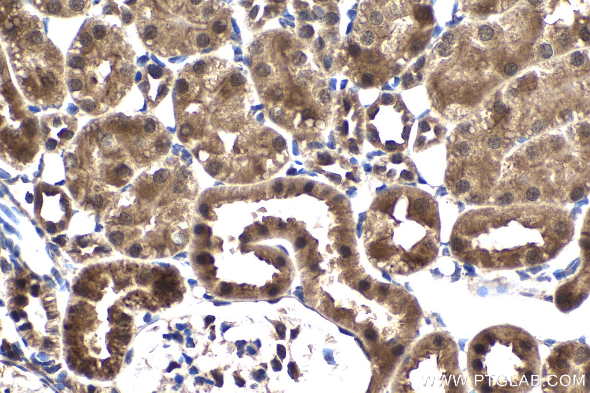 Immunohistochemical analysis of paraffin-embedded rat kidney tissue slide using KHC1511 (CDK1 IHC Kit).