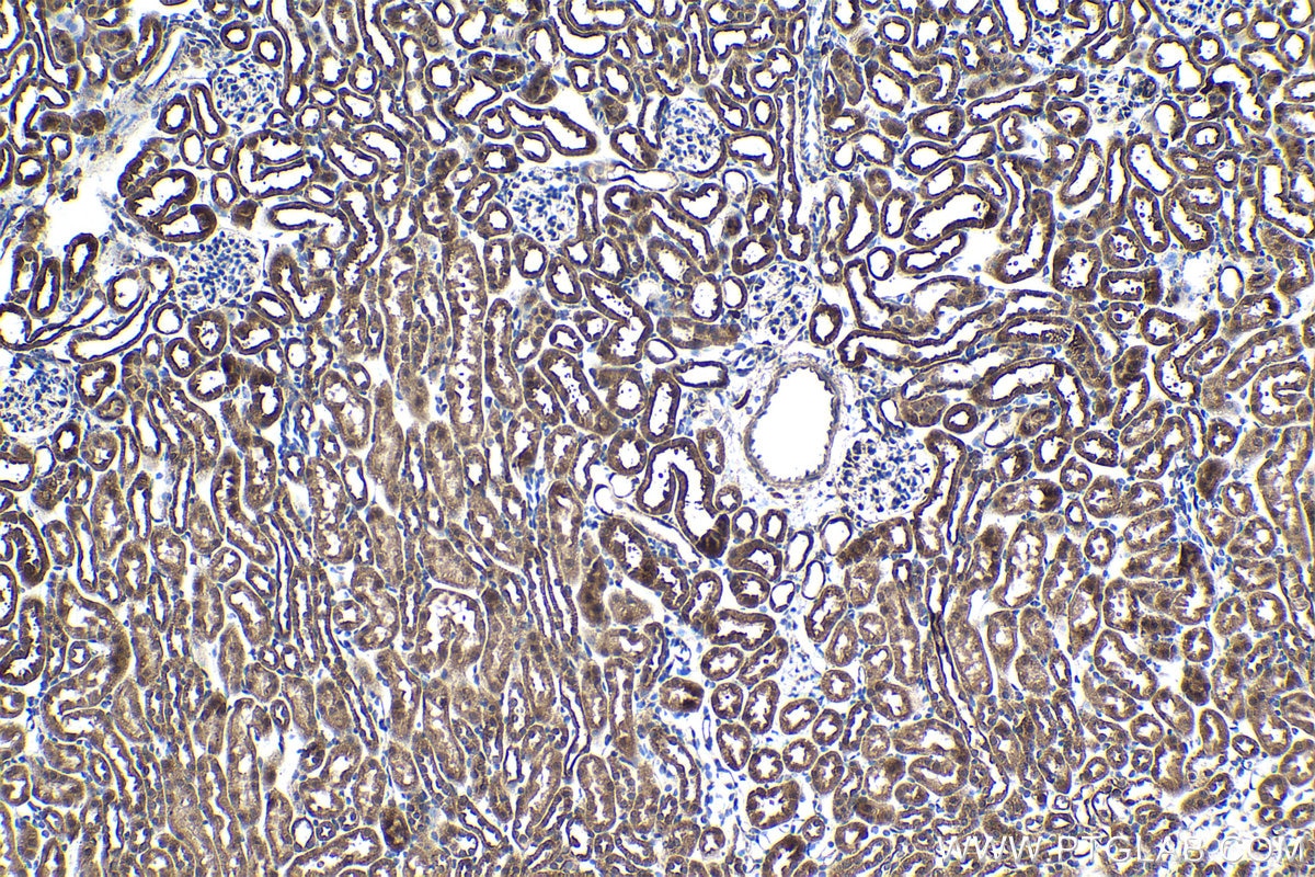 Immunohistochemical analysis of paraffin-embedded mouse kidney tissue slide using KHC1511 (CDK1 IHC Kit).