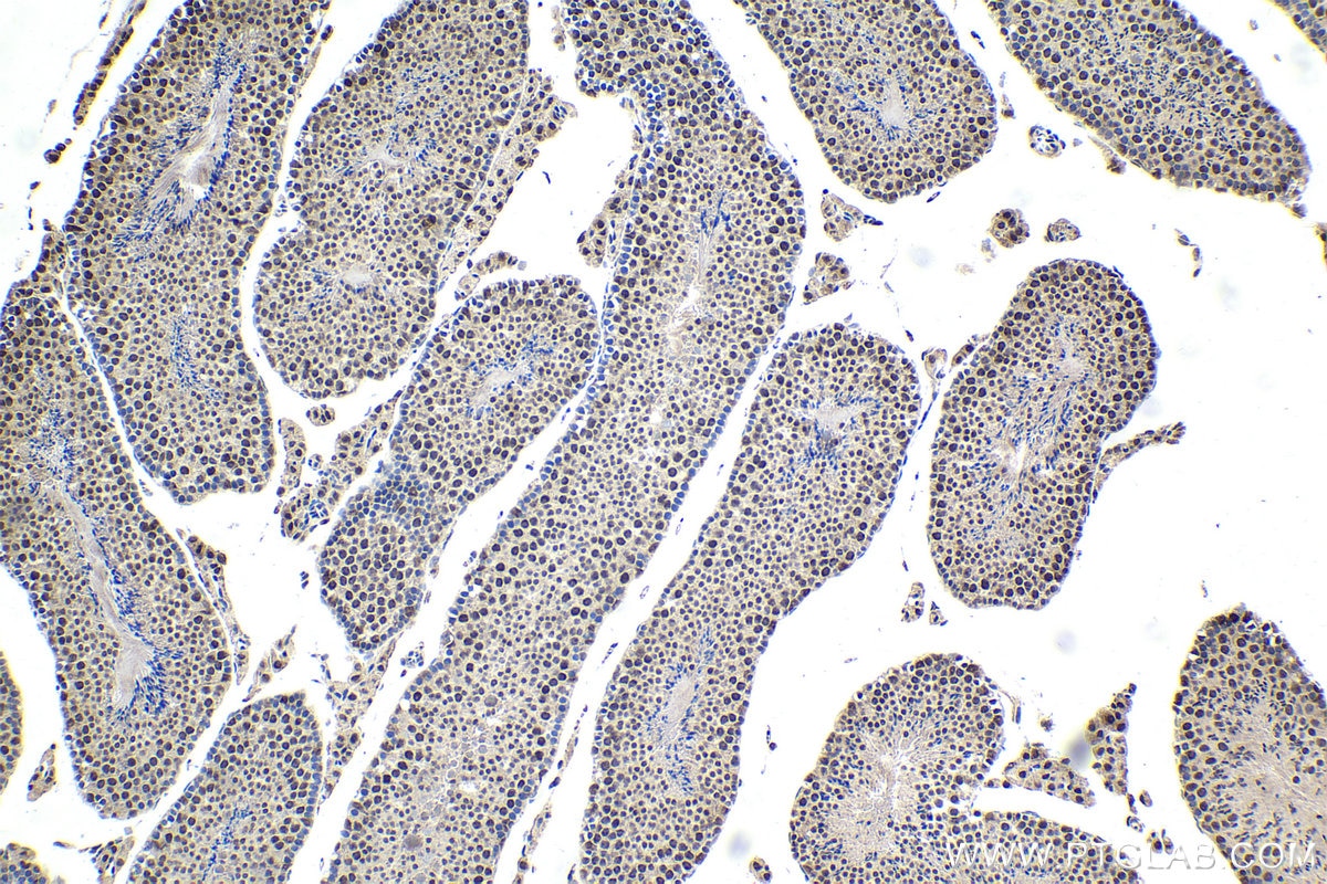 Immunohistochemical analysis of paraffin-embedded mouse testis tissue slide using KHC1723 (CDK13 IHC Kit).