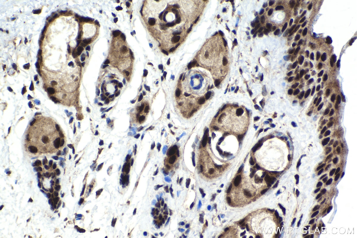 Immunohistochemical analysis of paraffin-embedded mouse skin tissue slide using KHC1723 (CDK13 IHC Kit).