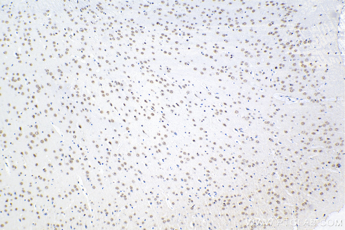 Immunohistochemical analysis of paraffin-embedded mouse brain tissue slide using KHC2053 (CDK2AP1 IHC Kit).