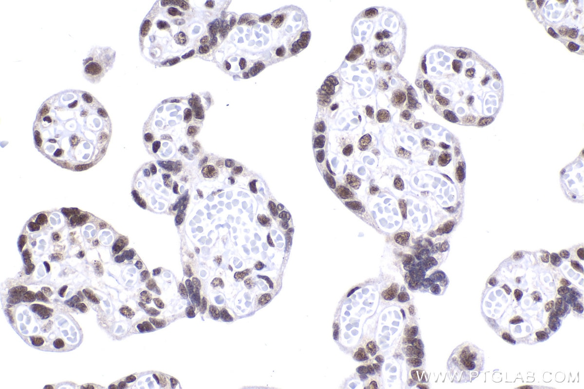 Immunohistochemical analysis of paraffin-embedded human placenta tissue slide using KHC2053 (CDK2AP1 IHC Kit).