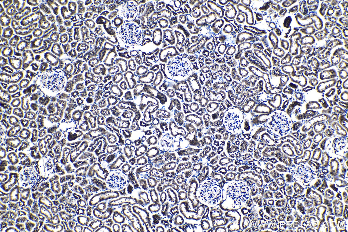 Immunohistochemical analysis of paraffin-embedded rat kidney tissue slide using KHC1187 (CDK3 IHC Kit).