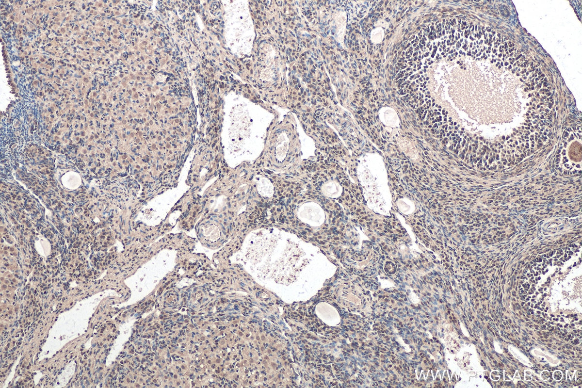 Immunohistochemical analysis of paraffin-embedded rat ovary tissue slide using KHC0303 (CDK4 IHC Kit).