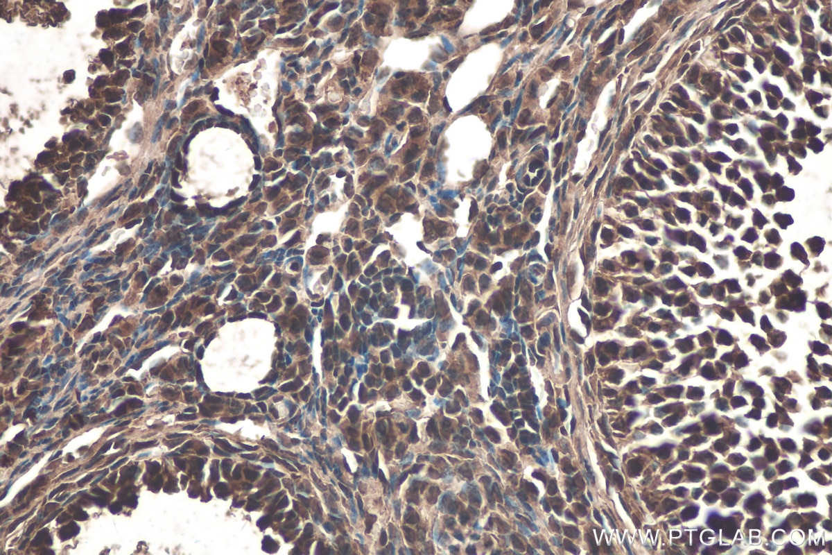 Immunohistochemical analysis of paraffin-embedded mouse ovary tissue slide using KHC0303 (CDK4 IHC Kit).