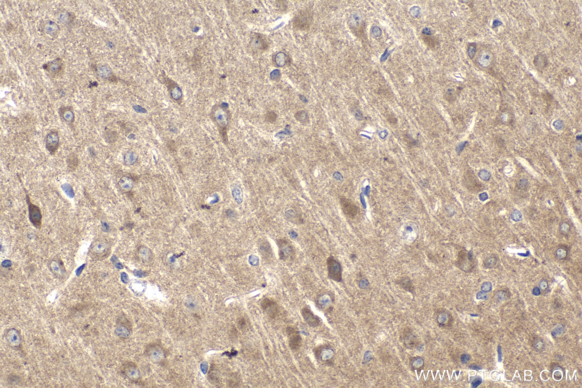 Immunohistochemical analysis of paraffin-embedded mouse brain tissue slide using KHC1748 (CDK5R1 IHC Kit).