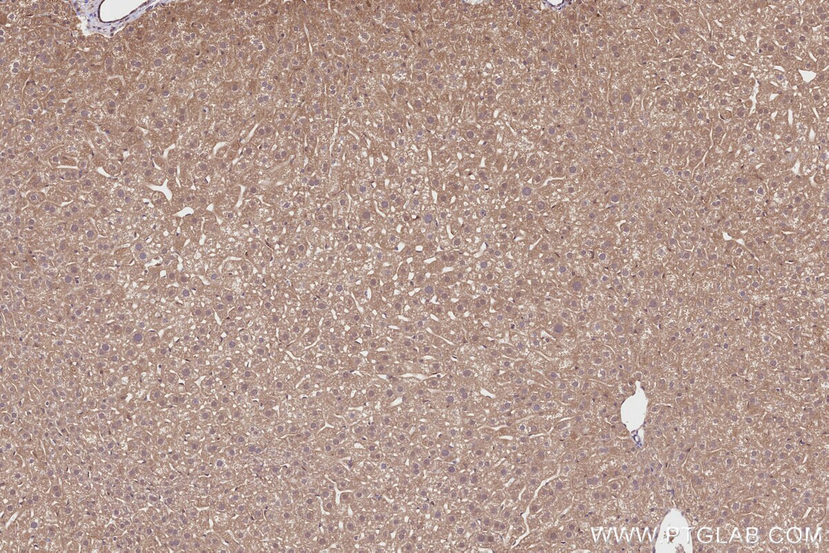 Immunohistochemical analysis of paraffin-embedded mouse liver tissue slide using KHC2834 (CDK5RAP2 IHC Kit).