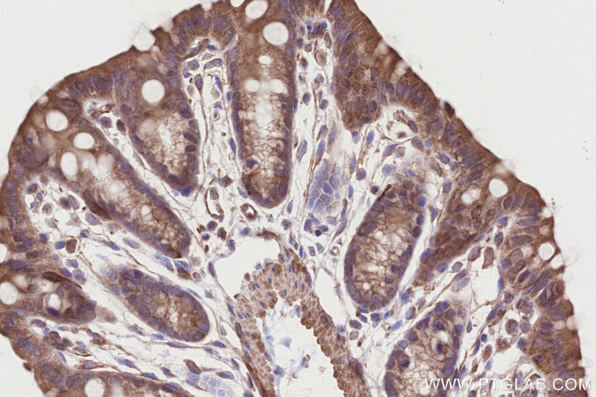 Immunohistochemical analysis of paraffin-embedded mouse colon tissue slide using KHC2834 (CDK5RAP2 IHC Kit).