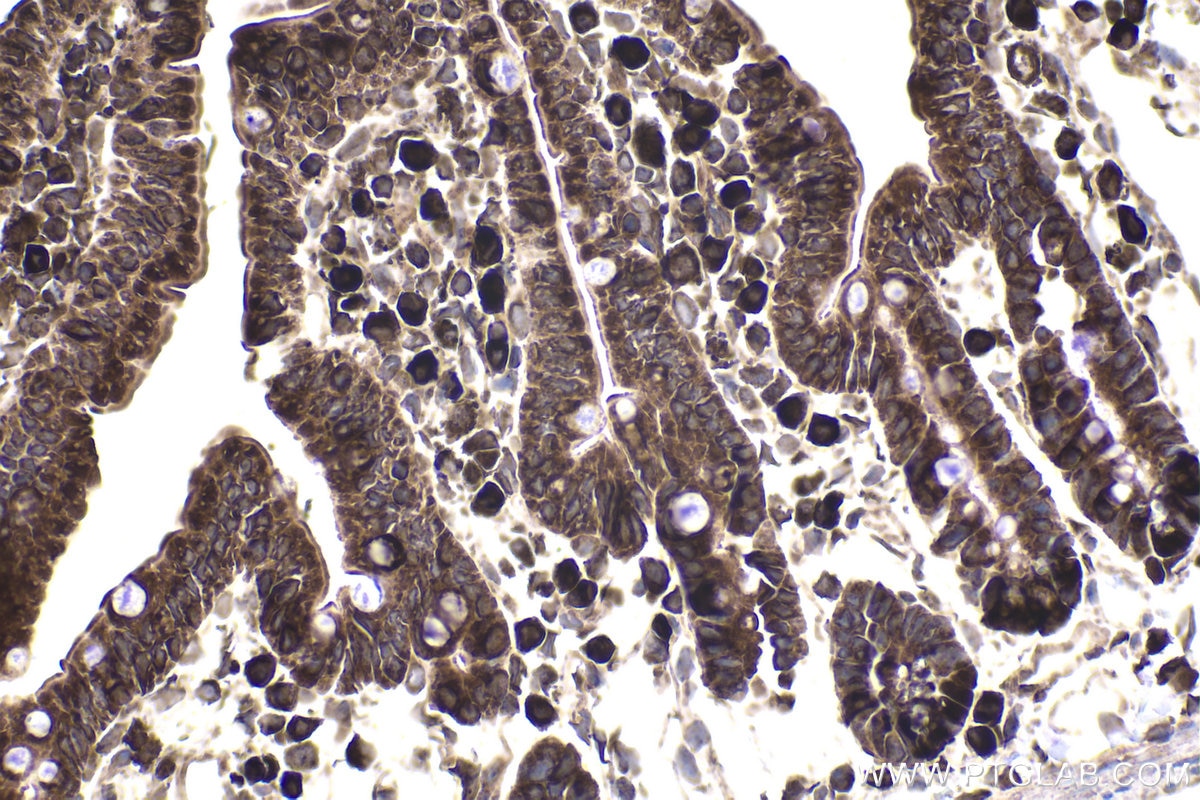 Immunohistochemical analysis of paraffin-embedded mouse small intestine tissue slide using KHC1876 (CDK5RAP3 IHC Kit).