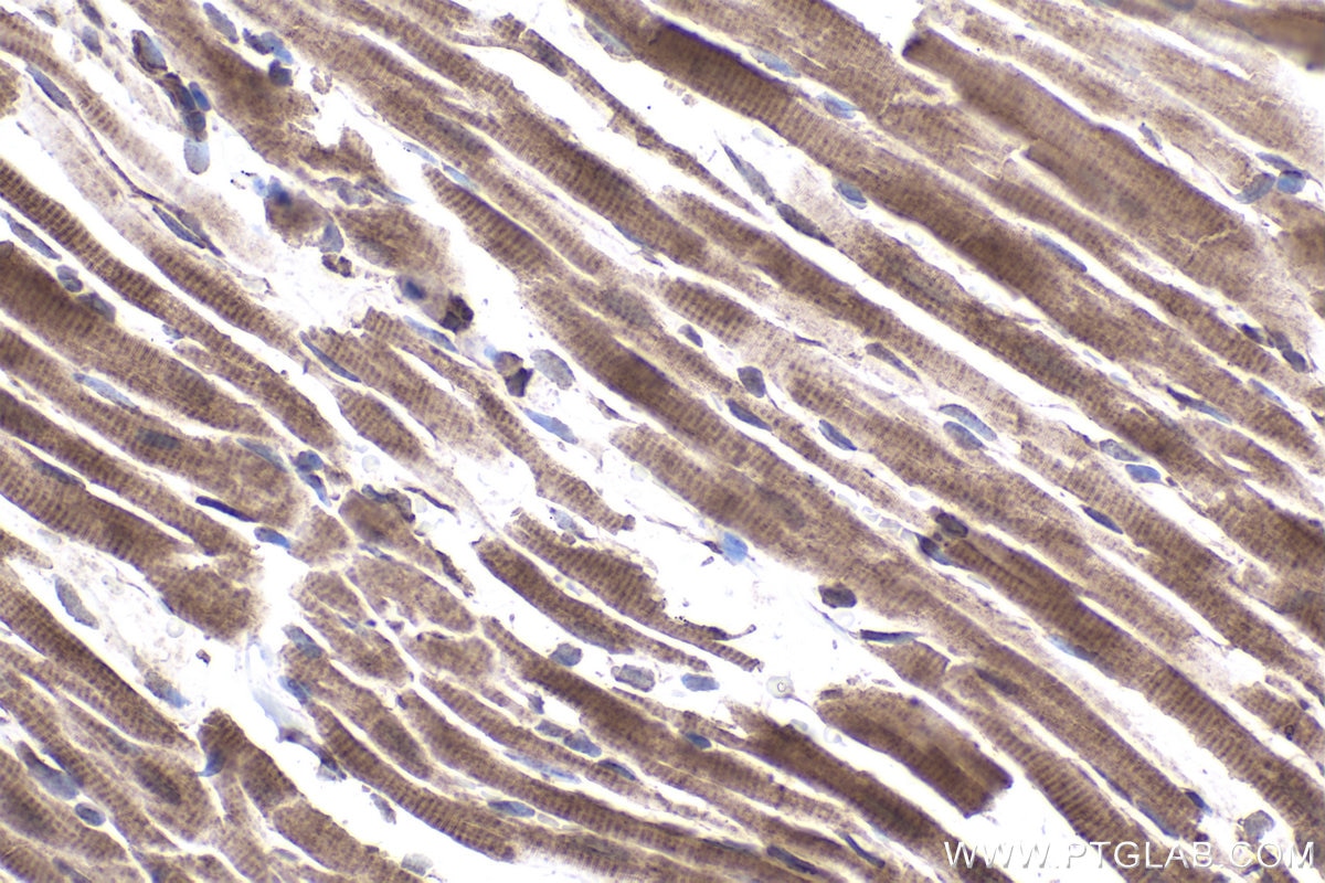 Immunohistochemical analysis of paraffin-embedded rat heart tissue slide using KHC1876 (CDK5RAP3 IHC Kit).