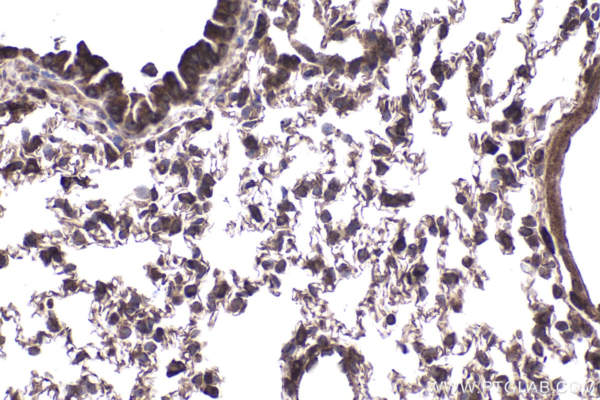 Immunohistochemical analysis of paraffin-embedded mouse lung tissue slide using KHC1876 (CDK5RAP3 IHC Kit).
