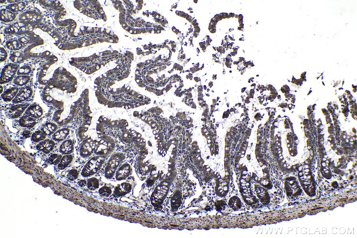 Immunohistochemical analysis of paraffin-embedded rat small intestine tissue slide using KHC1068 (CDK6 IHC Kit).