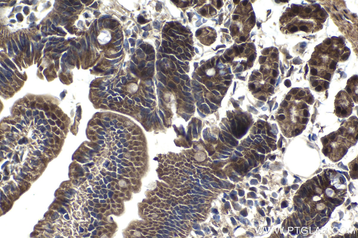 Immunohistochemical analysis of paraffin-embedded mouse small intestine tissue slide using KHC1068 (CDK6 IHC Kit).