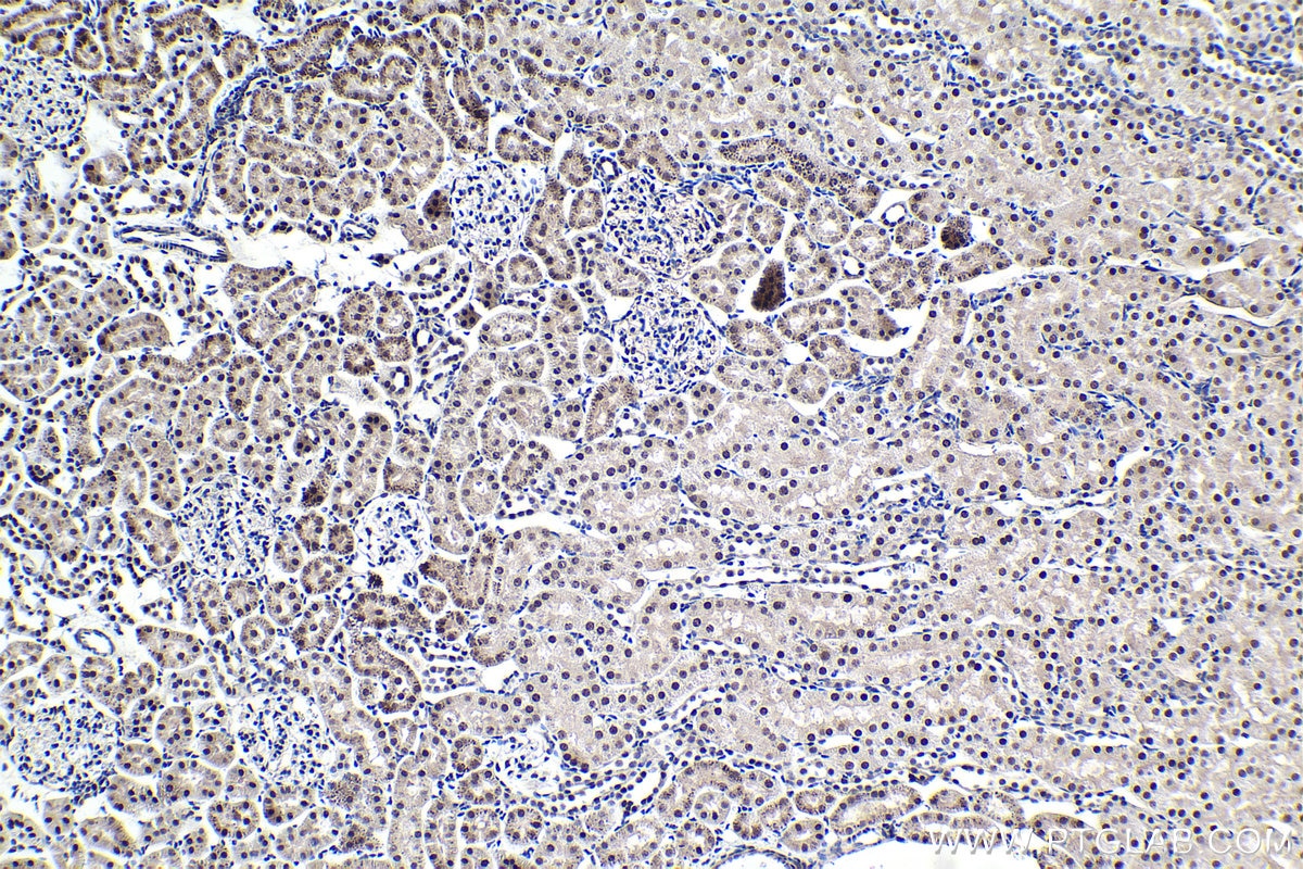 Immunohistochemical analysis of paraffin-embedded rat kidney tissue slide using KHC1617 (CDK9 IHC Kit).