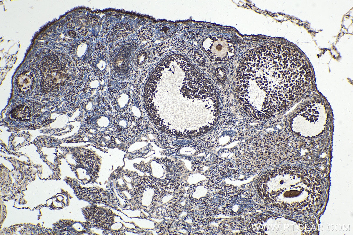 Immunohistochemical analysis of paraffin-embedded mouse ovary tissue slide using KHC1617 (CDK9 IHC Kit).