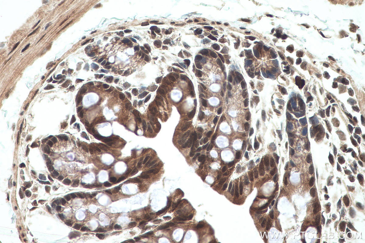 Immunohistochemical analysis of paraffin-embedded mouse colon tissue slide using KHC0773 (CDKN1B IHC Kit).