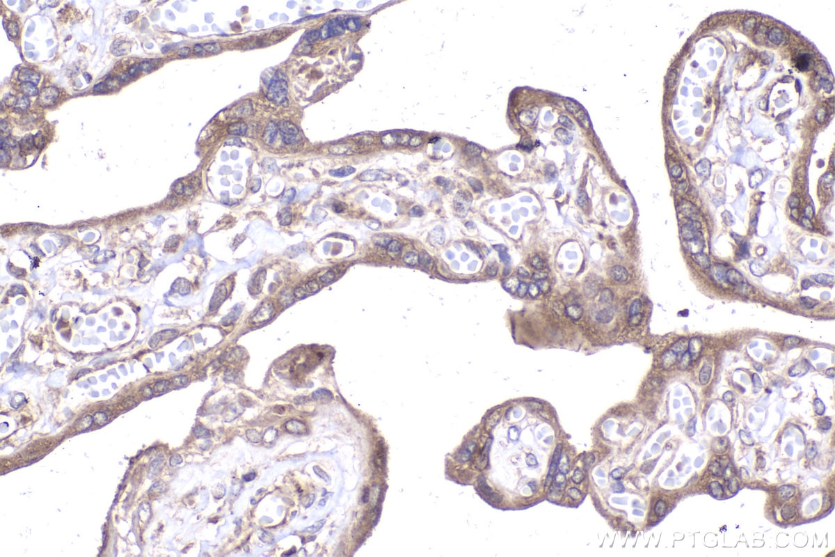 Immunohistochemical analysis of paraffin-embedded human placenta tissue slide using KHC2037 (CDR2L IHC Kit).