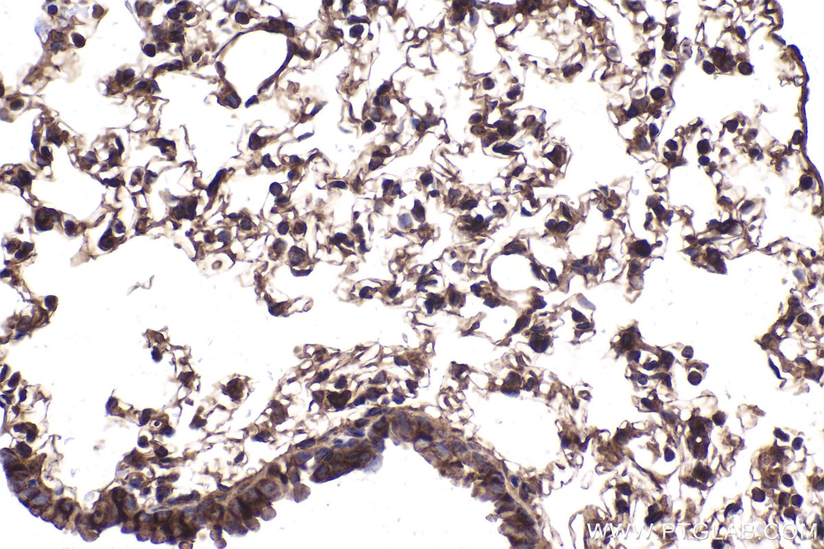 Immunohistochemical analysis of paraffin-embedded mouse lung tissue slide using KHC2037 (CDR2L IHC Kit).