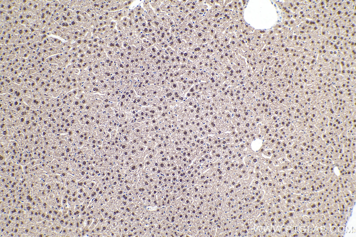 Immunohistochemical analysis of paraffin-embedded mouse liver tissue slide using KHC0239 (CEBPB IHC Kit).