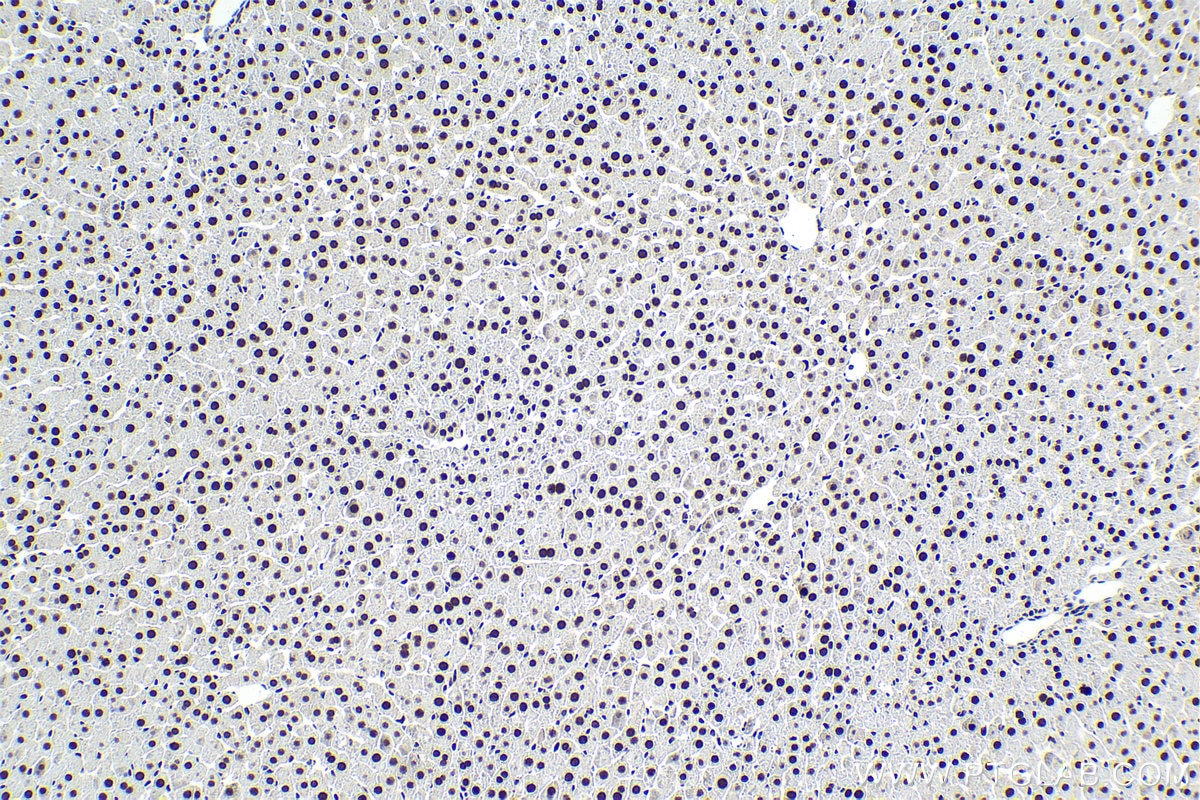 Immunohistochemical analysis of paraffin-embedded rat liver tissue slide using KHC1625 (CEBPG IHC Kit).