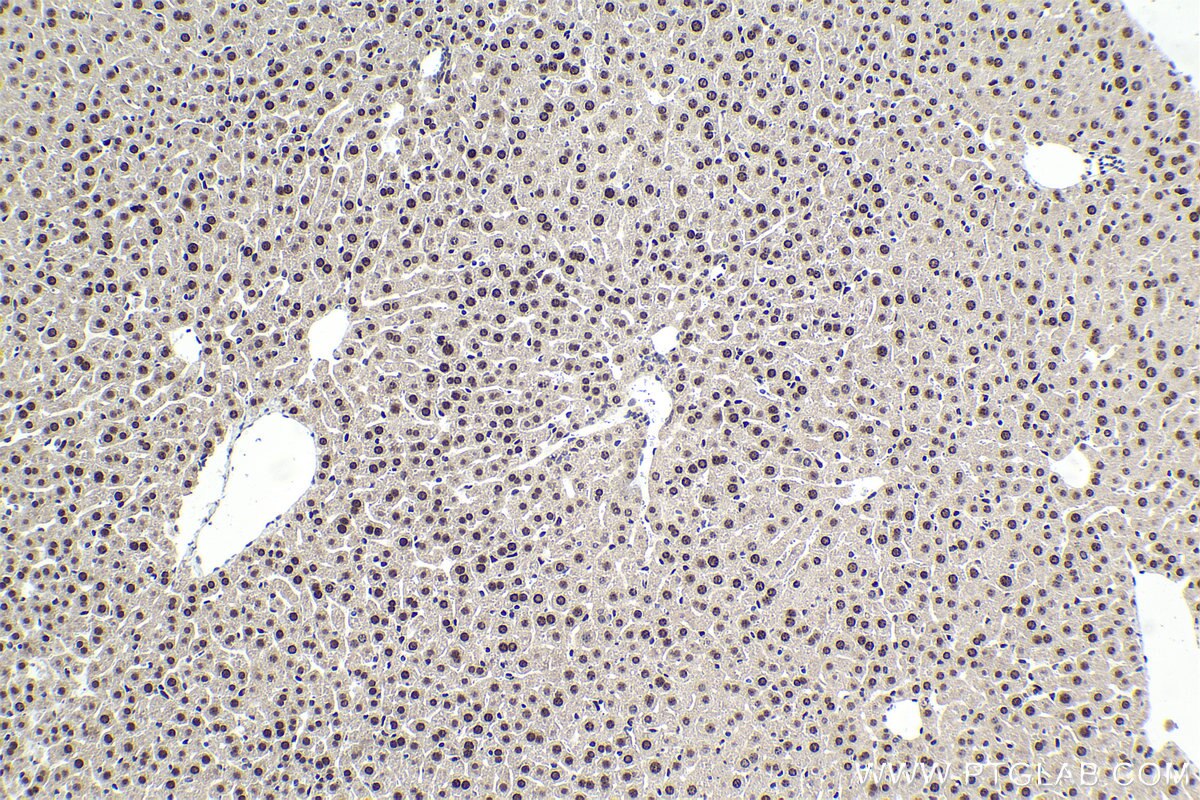 Immunohistochemical analysis of paraffin-embedded mouse liver tissue slide using KHC1625 (CEBPG IHC Kit).