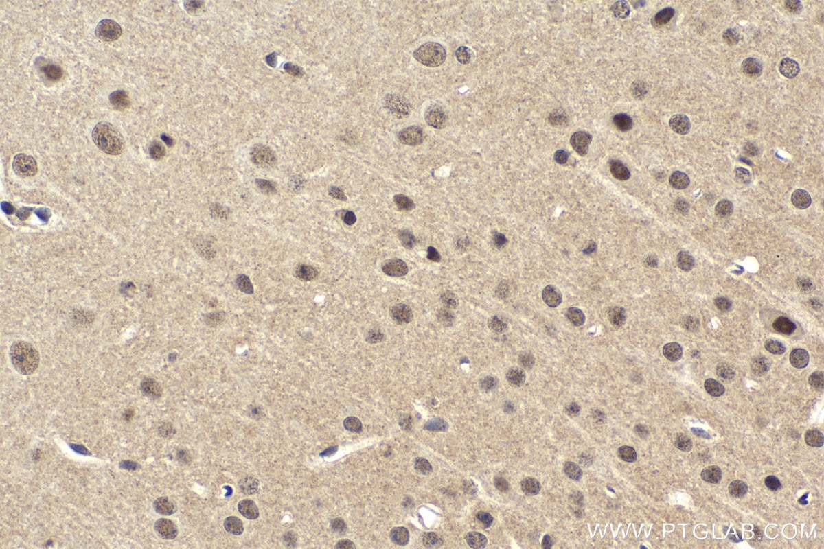 Immunohistochemical analysis of paraffin-embedded mouse brain tissue slide using KHC1625 (CEBPG IHC Kit).
