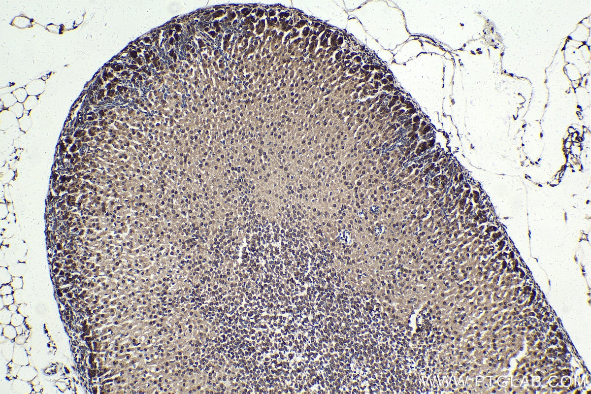 Immunohistochemical analysis of paraffin-embedded mouse adrenal gland tissue slide using KHC1778 (CELF3 IHC Kit).