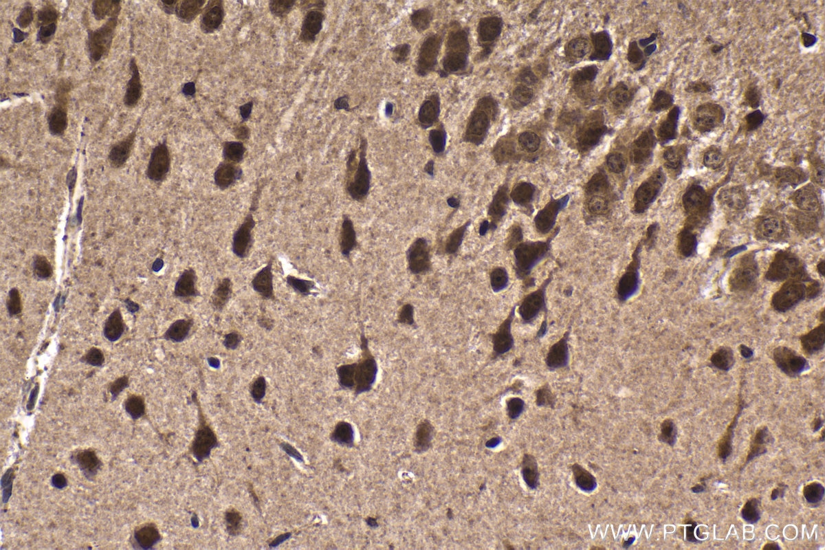 Immunohistochemical analysis of paraffin-embedded mouse brain tissue slide using KHC1778 (CELF3 IHC Kit).
