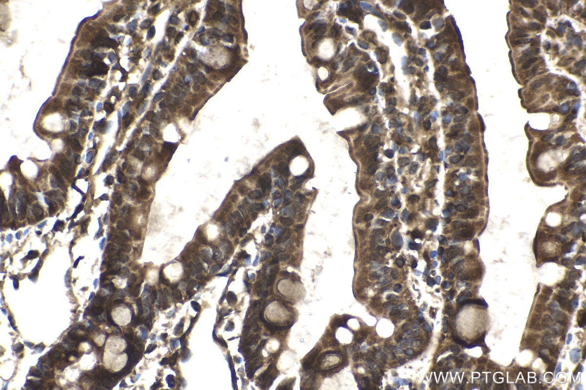 Immunohistochemical analysis of paraffin-embedded rat small intestine tissue slide using KHC1779 (CEP162 IHC Kit).