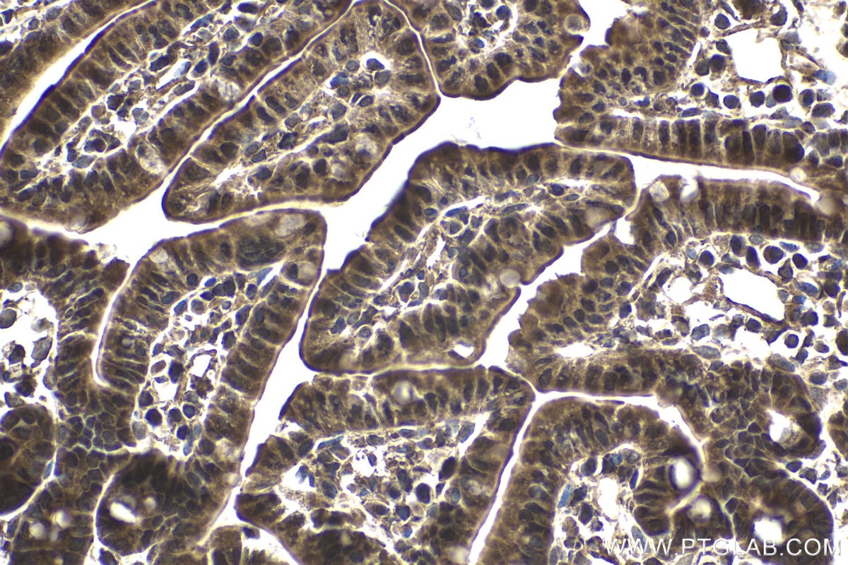 Immunohistochemical analysis of paraffin-embedded mouse small intestine tissue slide using KHC1779 (CEP162 IHC Kit).