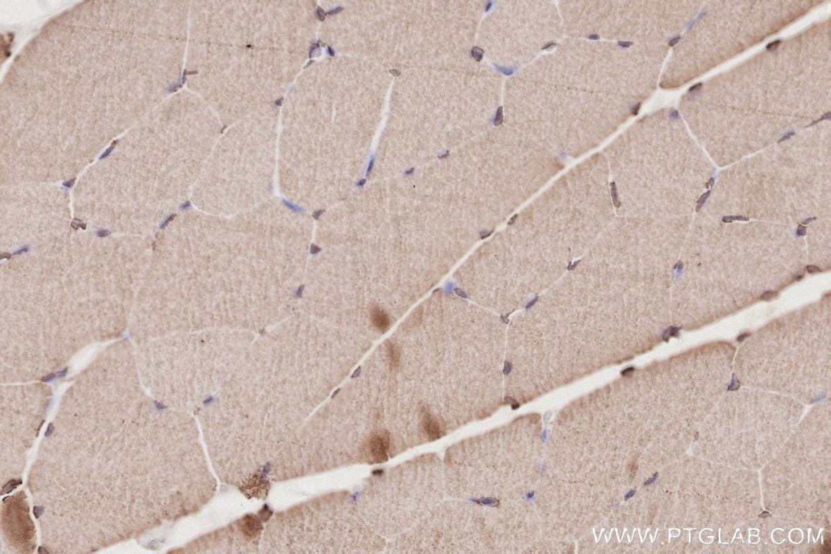 Immunohistochemical analysis of paraffin-embedded rat skeletal muscle tissue slide using KHC2872 (CEP250/CNAP1 IHC Kit).