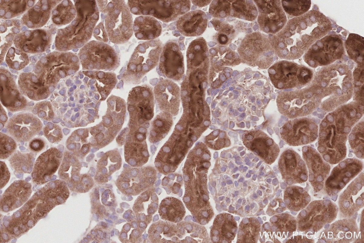 Immunohistochemical analysis of paraffin-embedded mouse kidney tissue slide using KHC2892 (CEP295 IHC Kit). Immunohistochemical analysis of paraffin-embedded mouse kidney tissue slide using KHC2892 (CEP295 IHC Kit).
